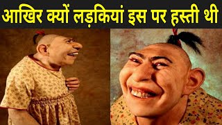 लड़कियां इस पर हस्ती थी कारण जानकर हैरान हो जाएंगे | Schlitzie Video In Hindi
