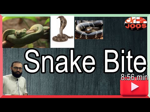 Video: Snake Bites: Jenis, Gejala, Dan Perawatan
