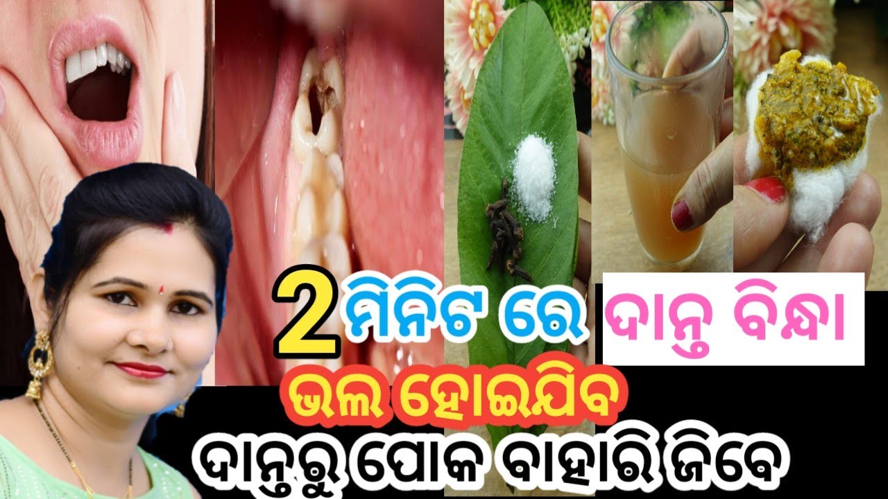 ୨ ମିନିଟ ରେ ଦାନ୍ତ ବିନ୍ଧା ଭଲ ଦାନ୍ତ ର ପୋକ ବାହାରୁଯିବେ,teeth pain odia, danta bindha, danta poka,odiavlog