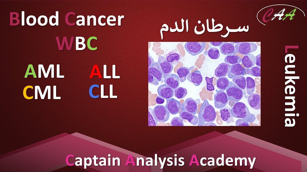 What is the Blood Cancer ? #Leukemia  خلايا الدم البيضاء وشرح تفصيلى لسرطان الدم