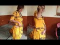 Bhabhi ji ko injection 💉😭 lagana padha | funny video | comedy video | injection video 💉