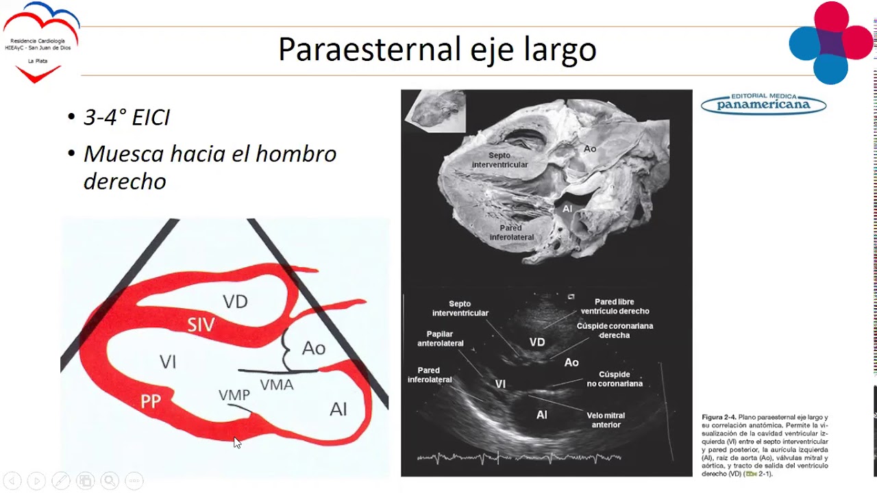 MODULO ECOCARDIOGRAFIA - INTRODUCCION - S.YULIDORE
