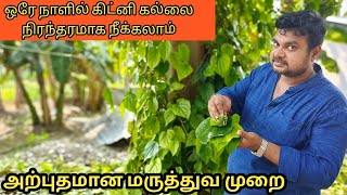 kidney stone 24' mm வரை இருந்தாலும் அசால்டா கரைக்கலாம் | Yummy  vlogs