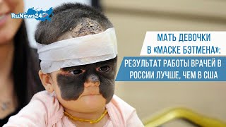 Мать Девочки В «Маске Бэтмена»: Результат Работы Врачей В России Лучше, Чем В Сша / Runews24