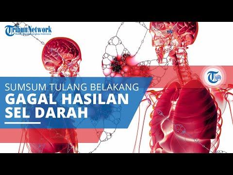 Anemia Aplastik, Jenis Kelainan Darah Disebabkan Kegagalan Sumsum Tulang Menghasilkan Sel Darah