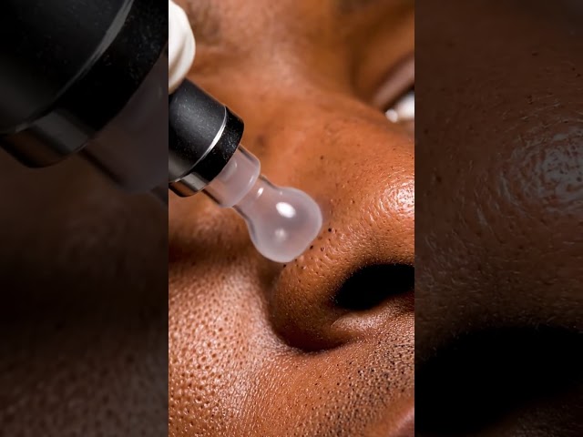 Full Face Transformation Through Deep Cleaning