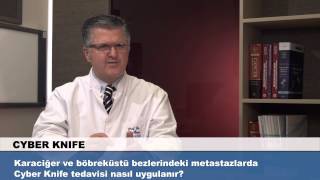 Karaciğer Ve Böbreküstü Bezlerindeki Metastazlarda Cyber Knife Tedavisi Nasıl Uygulanır?