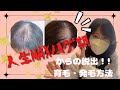 薄毛脱出！！2年半取り組んできた育毛・発毛方法