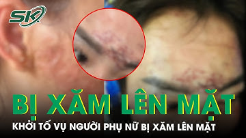 Khởi tố vụ người phụ nữ ở Cà Mau bị xăm lên mặt, ‘tra tấn’ bằng axit nghi do ghen tuông | SKĐS