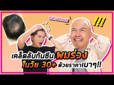 เคล็ดลับการกันซีนผมร่วงในวัย 30+ ด้วยราคาแบบมิตรภาพ!!