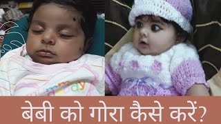 बच्चे को गोरा कैसे बनाए/How to make baby fair:facts and myths.