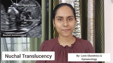Nuchal Translucency Interpretation, Pregnancy 1st Trimester Ultrasound @Love_Obs_Gynae