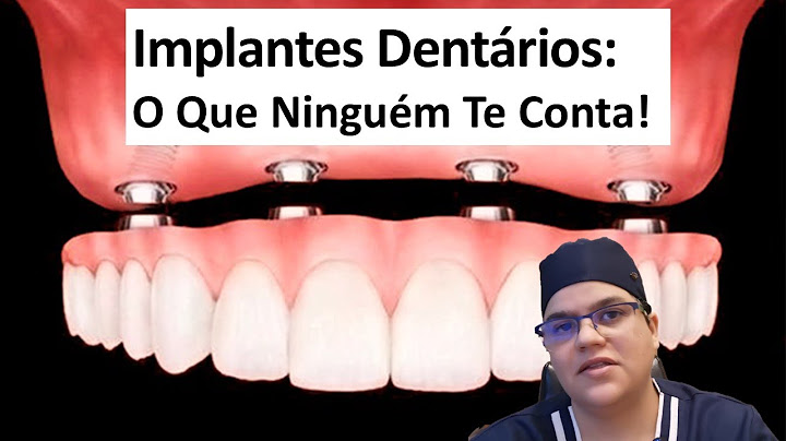O que ninguém te conta sobre implantes dentários!| Master Pride Odontologia | Dra Bianca Rosa