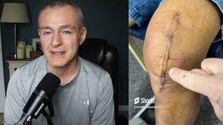 Worst Day After Knee Replacement