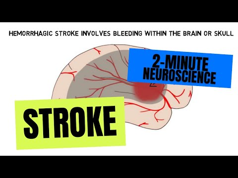 2-Minute Neuroscience: Stroke