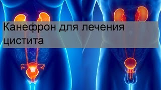 Канефрон для лечения цистита