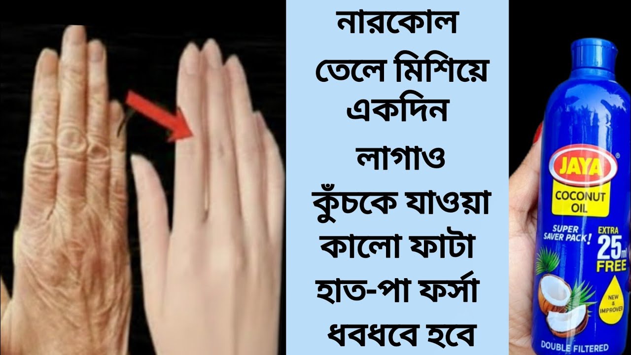 Смешайте его с кокосовым маслом и нанесите на шершавые, потрескавшиеся, темные руки и ноги — за н...