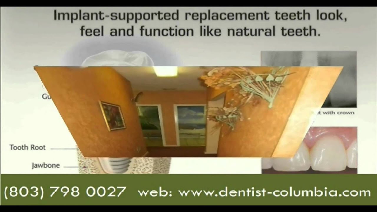 Cosmetic dentist Columbia South Carolina 8037980027 YouTube