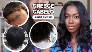 🚨 3 MÉTODOS INFALÍVEIS QUE VÃO FAZER SEU CABELO CRESCER RÁPIDO AINDA EM 2023 | RECEITAS DA ROÇA 😱😲