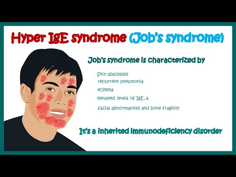 Hyper IgE syndrome (Job&rsquo;s syndrome ) || Immunodeficiency disorder || clinical features