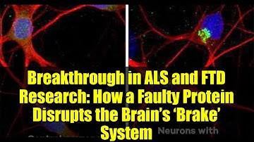 Breakthrough in ALS and FTD Research: How a Faulty Protein Disrupts the Brain’s ‘Brake’ System