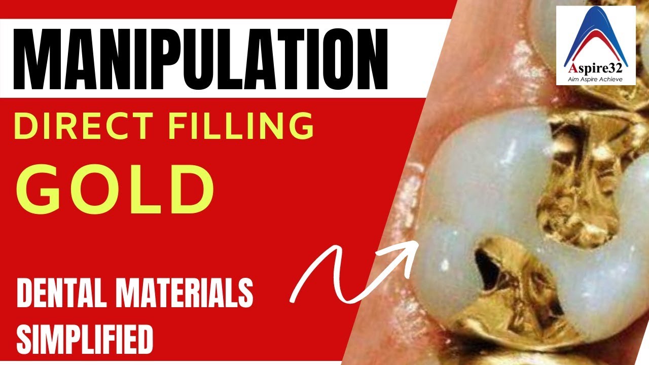 Manipulation of Direct Filling Gold Aspire32 YouTube