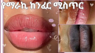 የከንፈር መጥቆር ነጭ ነጠብጣብ እና መድረቅ መፍትሔ/Lip Care Hack