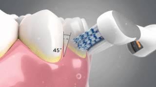 The Technology behind the Colgate® ProClinical® A1500 Electric Toothbrush