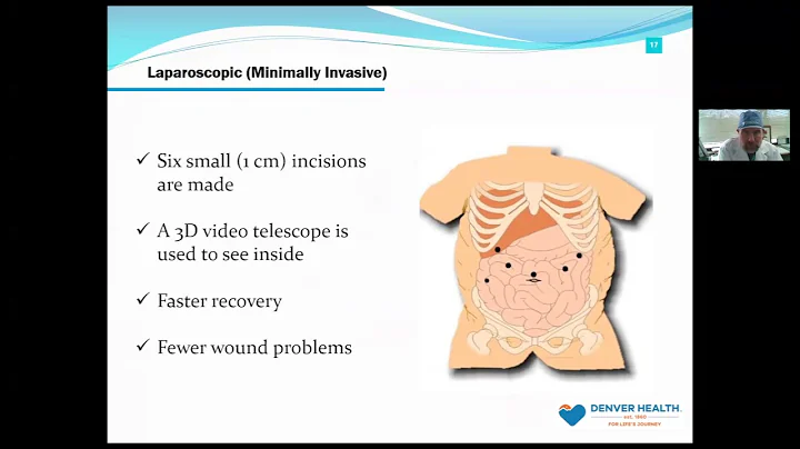 Denver Health Bariatric Surgery Center Virtual Sem...