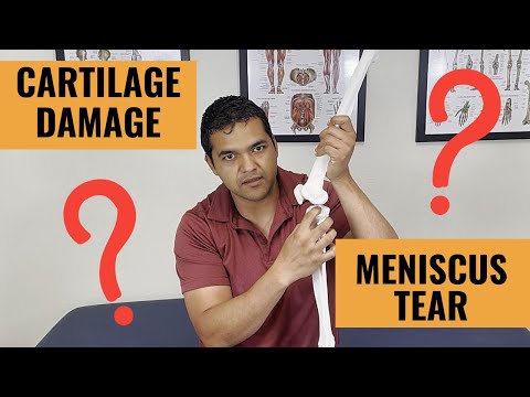 Knee Cartilage Damage VS Meniscus Tear - Which Do You Have?