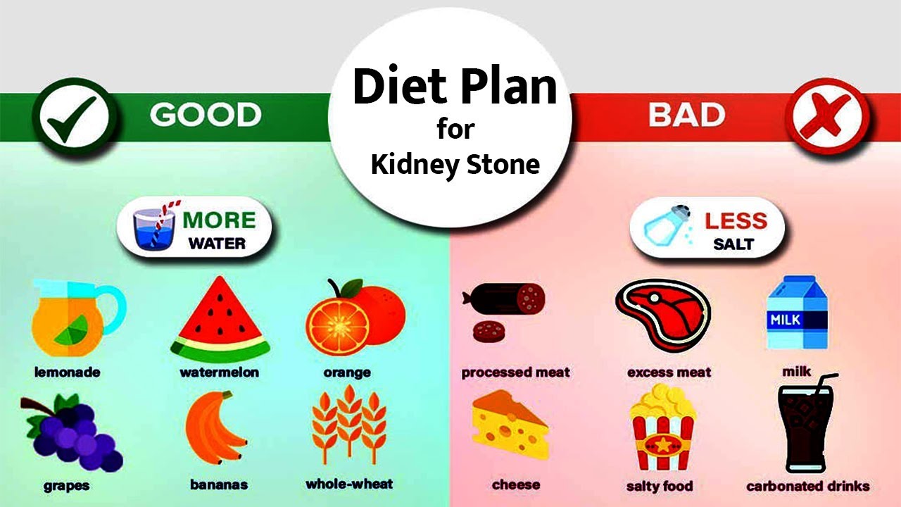 Food Chart For Kidney Stone Patient