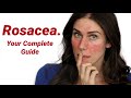 Why does everyone get rosacea wrong what it is and how to treat it