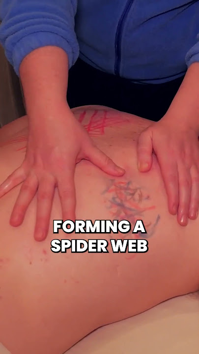 What Happens When Scar Tissue Forms #ScarTissue #ChiropracticCare #InjuryRecovery