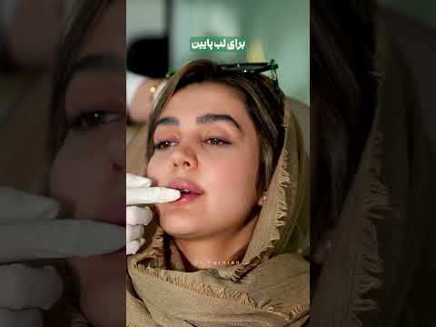 ماساژ لبها پس از تزریق فیلر