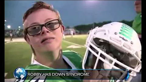 Robby Heil Inflicted with down syndrome scores tou...