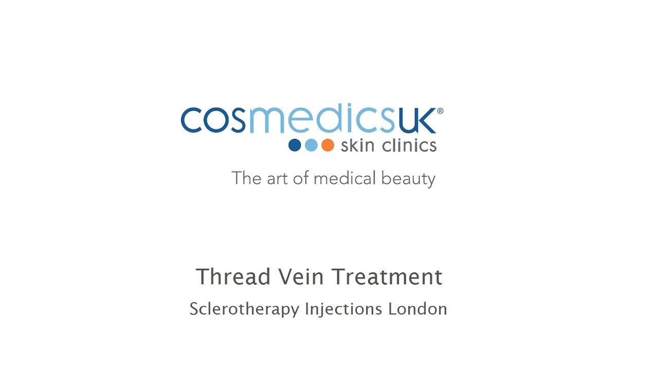 Cosmedics Skin Clinics Thread Vein Injections - YouTube
