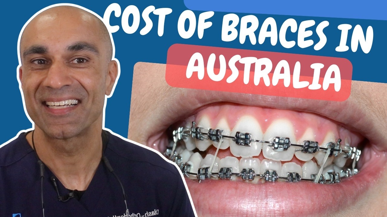 Cost of Braces in Australia in 2026