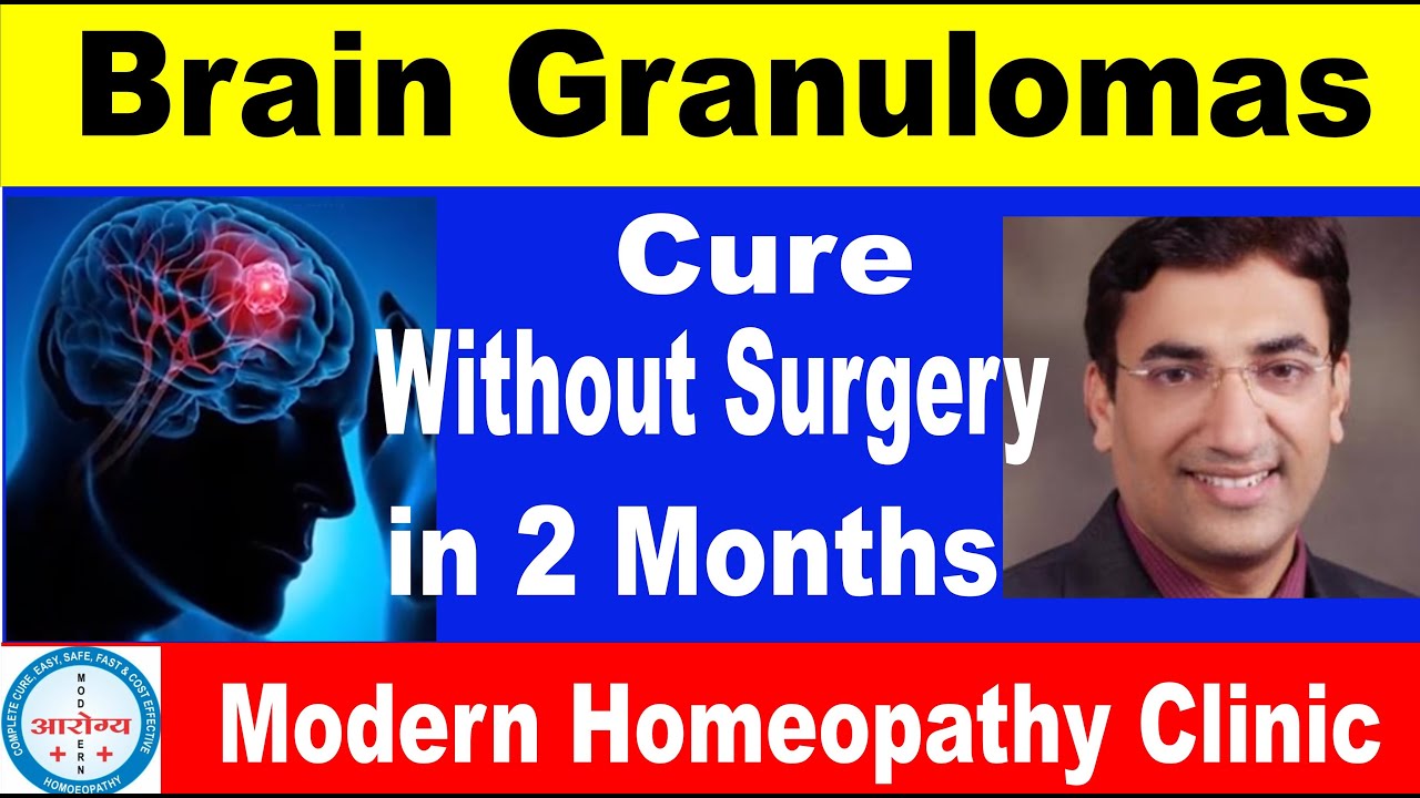 Brain Granulomas lesion | Treatment detail |Dr. Arpit Chopra Jain | Modern Homeopathy