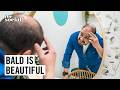 Bald Discrimination Must End | The Social