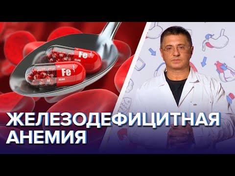 Железодефицитная анемия | Лечение | Симптомы - Доктор Мясников