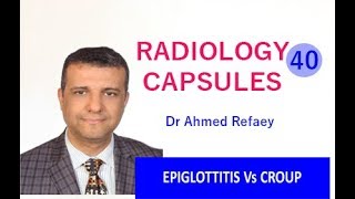 Radiology Capsules - 40 - Epiglottitis vs Croup