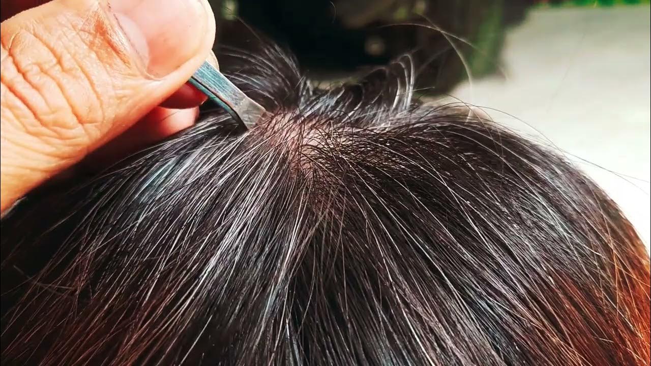 plucking-white-hair-part-5-youtube