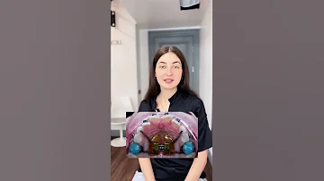 Узкая челюсть у ребёнка❗️Смотрите результат, который у нас получился, в конце видео🦷