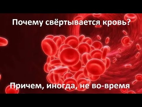 Почему свёртывается кровь? Причем, иногда, не во-время