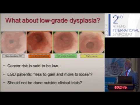 Prof. Jacques Bergman, Amsterdam, The Netherlands - HALO treatment of ...