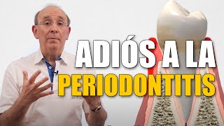 ¿Qué es la Periodontitis o Piorrea? La enfermedad de las encías