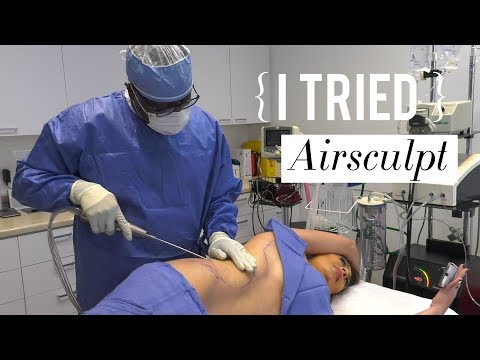 Vídeo: Airsculpt, Uma Alternativa à Cirurgia Plástica