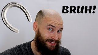 2 YEARS OF BALDING IN 2 MINUTES - Going Bald Fast Horse shoe