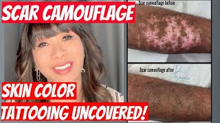 HOW TO CAMOUFLAGE SCARS  PERMANENT MAKE UP MANUAL TECHNIQUE, SOLUTIONS FOR INJURY OR SURGERY SCARS