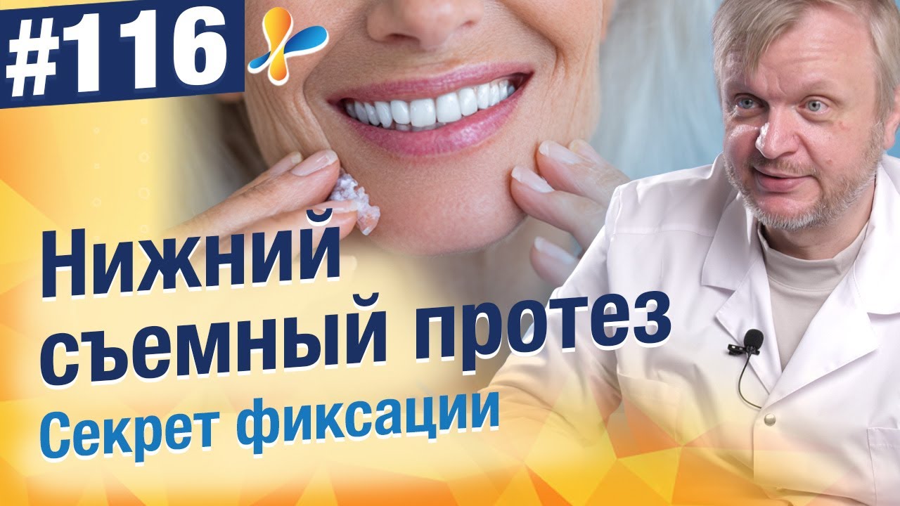 Съёмный протез постоянно шатается? Вот что реально помогает!